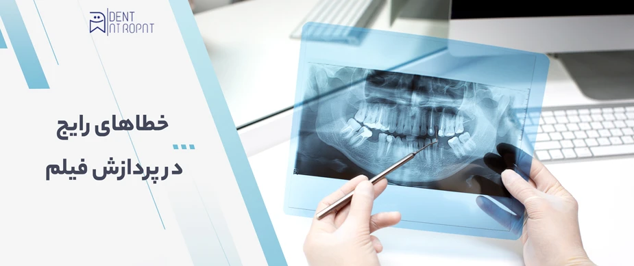 داروی ظهور و ثبوت دندانپزشکی