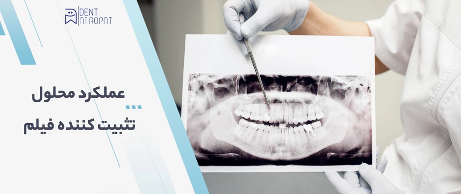 محلول ظهور و ثبوت رادیولوژی