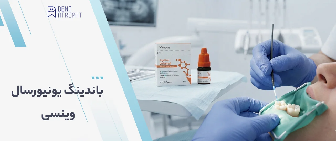 باندینگ یونیورسال وینسی اسمایل - VinciSmile Bond Universal 2 باندینگ یونیورسال وینسی